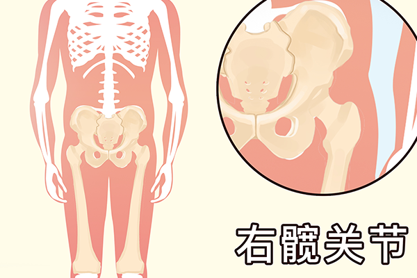 为什么运动后骨头疼