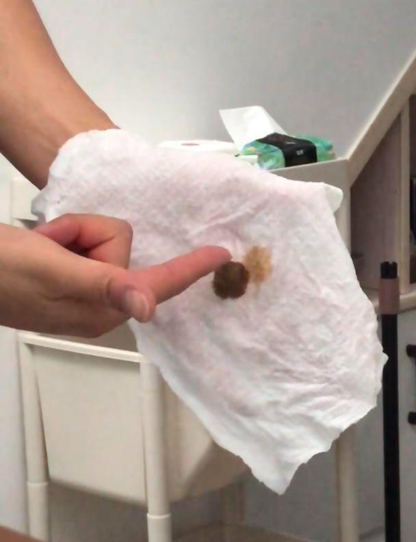 有居民用棉柔巾包裹住水龙头出水口，放水两分钟后，发现棉柔巾上留有深褐色的、疑似泥沙的沈淀物。(视频截屏)