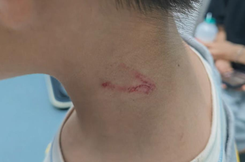 男童在医院接受治疗。(视频截屏)