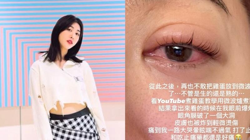 王晴用微波炉加热鸡蛋意外爆炸。(取材自王晴的Instagram)