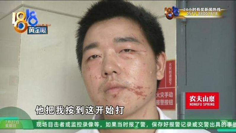 跟女网友在撞球厅见面的丁先生被打得满脸是伤。(视频截屏)