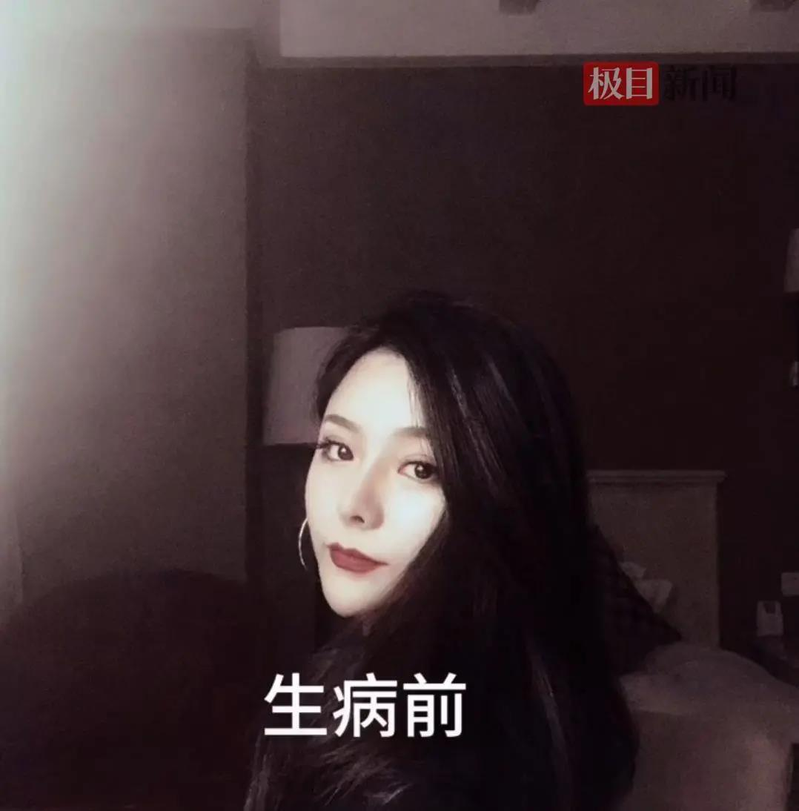 于悦每天都需要做透析治疗。(取材自极目新闻)