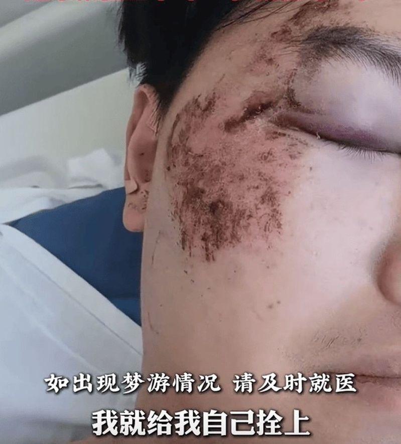 曹男的伤势。(取材自扬子晚报)