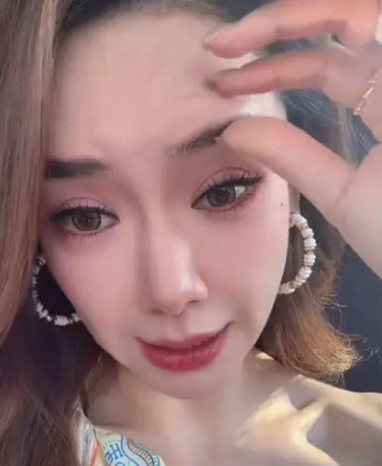 戚薇认了「吊梢眼」是因为打肉毒过量造成。(取材自微博)
