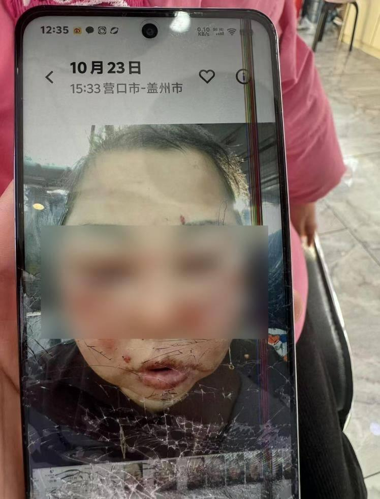于女士的母亲此前疑被前夫家暴，身上多处受伤。（取材自极目新闻）
