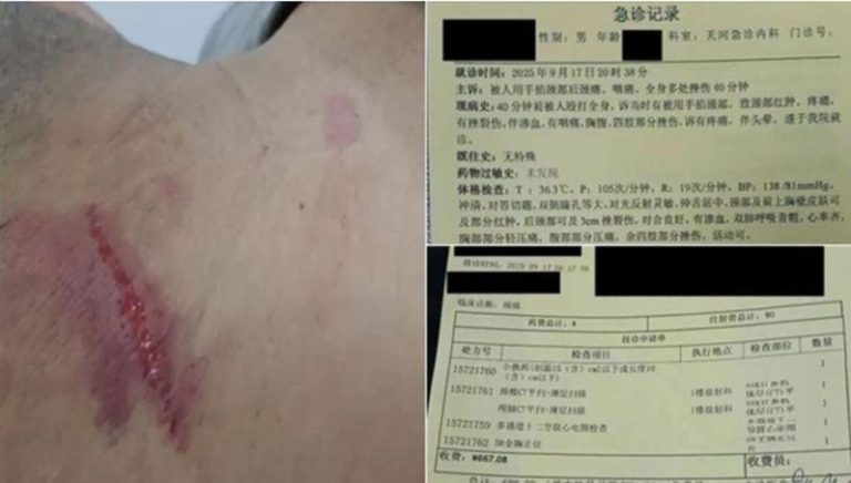 牛腾宇父亲被暴打受伤（图左）及就医的诊断记录（图右）。（视频截屏）