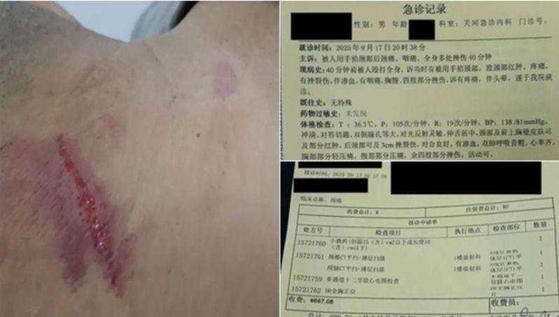牛腾宇父亲被暴打受伤(图左)及就医的诊断记录(图右)。(视频截屏)