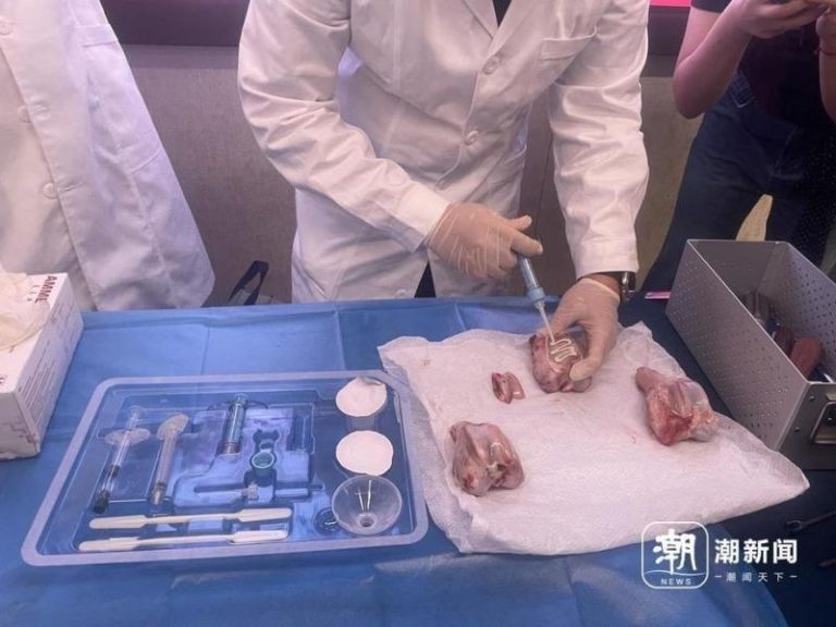 浙大邵逸夫医院研发出全球首款「骨胶水」，实现一针治愈骨折，为骨科领域带来颠覆性革新。(取材自潮新闻、湖南日报)