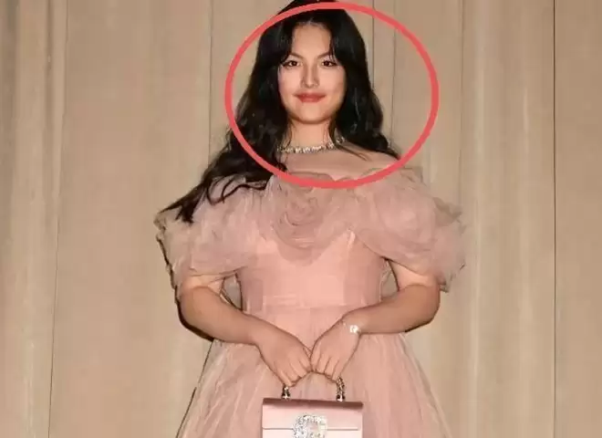 周迅近照曝光!头发发白,瘦到皮包骨,终究为恶习付出了代价