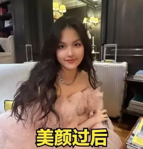 周迅近照曝光!头发发白,瘦到皮包骨,终究为恶习付出了代价