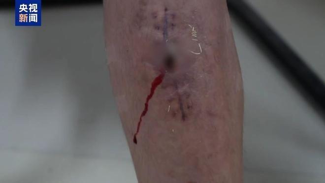 尸体埋葬现场。(取材自央视)