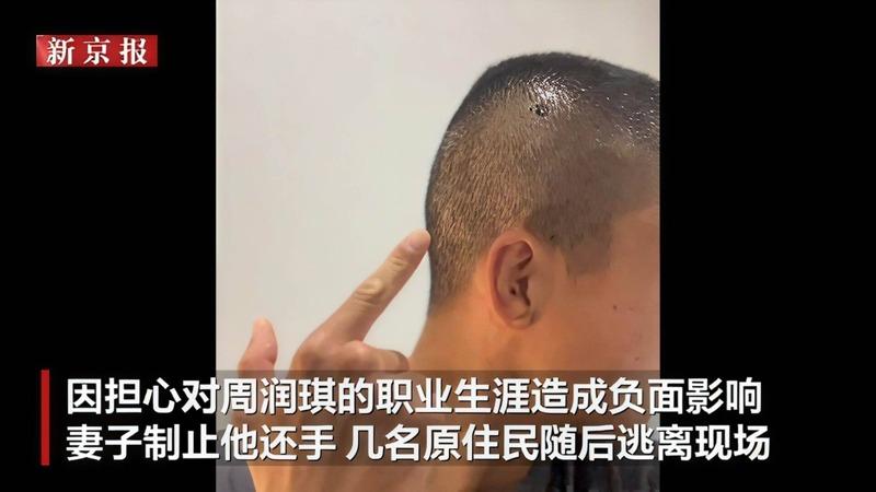 中国职业拳击手周润琪在澳洲乘公交车遇袭,头部被刺伤。(取材自新京报)