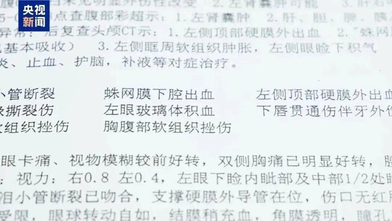 法院提醒，驾驶人应尽高度注意义务，以免因不当驾驶损害他人权益；示意图。（中新社）