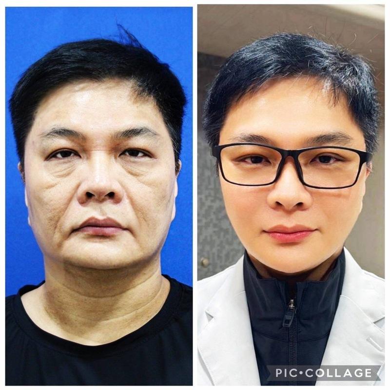 陈峙文分享自己做的对比照简直判若两人。图／阳光璨亮生医提供