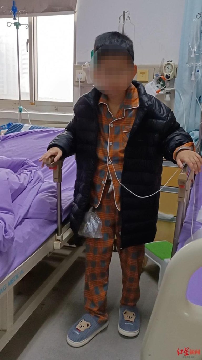 撞伤就医 10岁男孩开刀14小时切除6器官…母焦虑白了头 手术后的小烨。(取材自红星新闻)