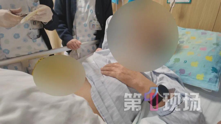广州男便秘十多天后 口腔喷出粪便 医:再晚一天就惨了 胡先生便秘十多天,紧急送医。(取材自第一现场)