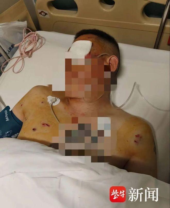 倪先生被抢劫后身受重伤。(取材自紫牛新闻)