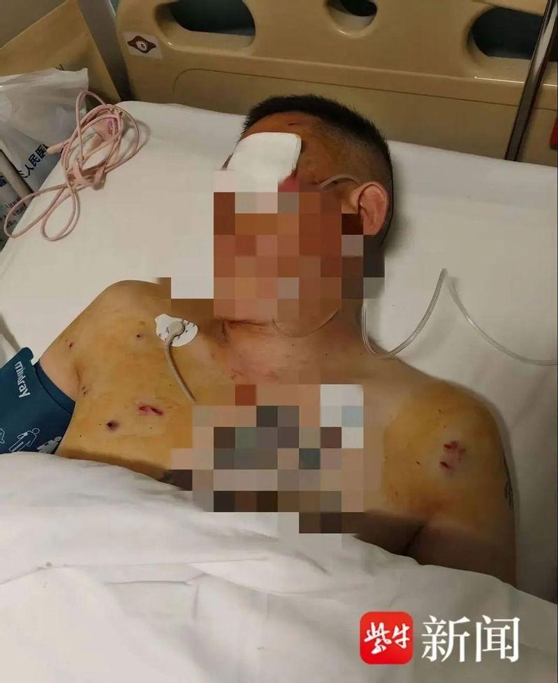 倪男遇抢受伤左眼失明。(取材自紫牛新闻)