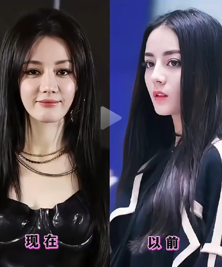 迪丽热巴现在的脸(左图)被指和过去的模样(右图)完全不同。（取材自微博）
