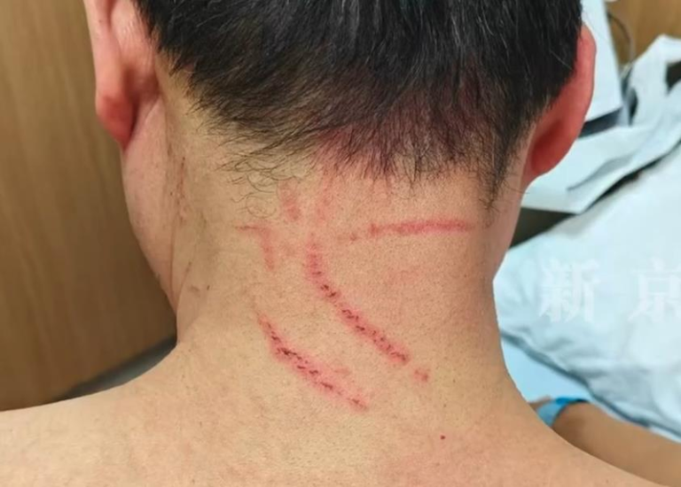 李男称被周女和其丈夫肖男抓伤。（视频截屏）