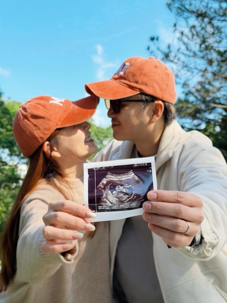 张书伟家族有双胞基因 谢京颖植入一胚胎怀双马宝 张书伟(右)模样看来憔悴不少。(图/Hit Fm联播网提供)