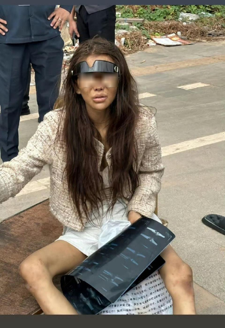 想赚高薪被男友哄骗到柬 20岁福建女网红骨折被弃街头 一名有2.4万粉丝的20岁福建网红Umi被拍到在柬埔寨街头精神恍惚、双腿骨折。(视频截屏)