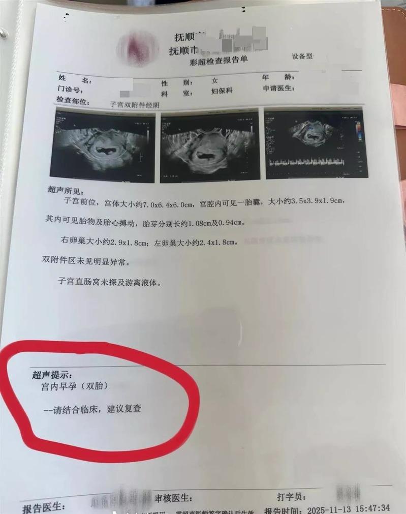 王女第一次产检时,只有一胎。(取材自极目新闻)