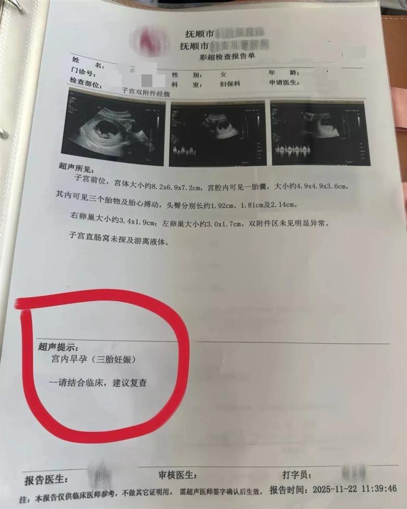 王女第一次产检时,只有一胎。(取材自极目新闻)