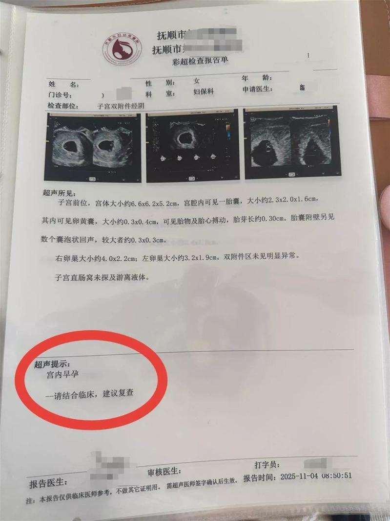 王女第一次产检时,只有一胎。(取材自极目新闻)