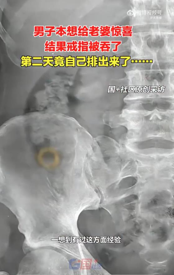 男子将金戒指藏汉堡内,竟被妻子吞下肚。(翻摄微博)