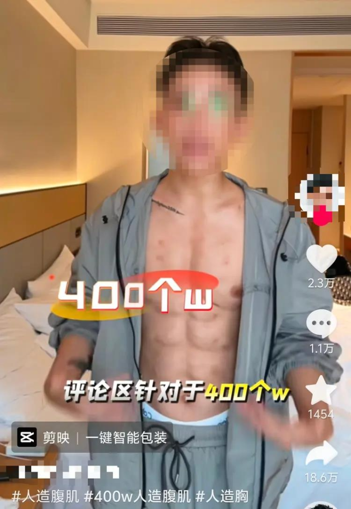 一名中国博主花了400万元注射玻尿酸塑造出肌肉。(取材自红星新闻)