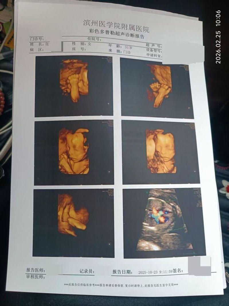 产检诊断报告。(取材自极目新闻)