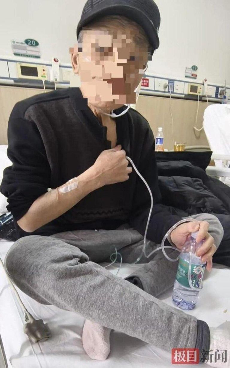 一名七旬老翁慢阻肺病情加重后反复引发气胸，多次住院。(取材自极目新闻)