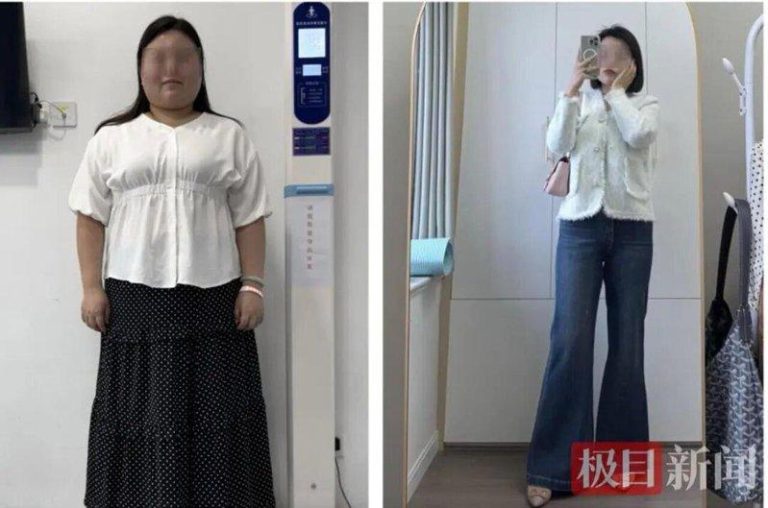 不只节食、运动…108公斤武汉女 1年减掉「半个自己」 林女士体重一度达到108公斤,花一年减掉半个自己,还逆转了多种疾病。(取材自极目新闻)