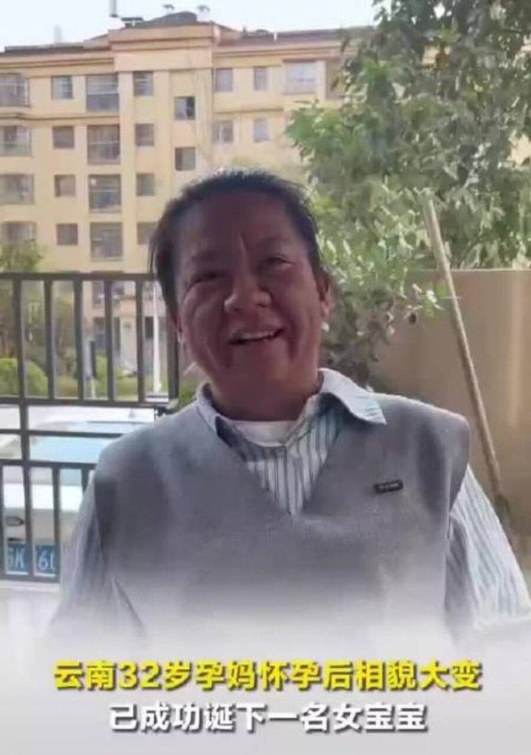 云南32岁女怀孕后容貌大变 「比母亲还老」 医揭原因 云南一名32岁女子怀孕后容貌明显改变,她自嘲「怀个孕,比母亲还老了」。(视频截屏...