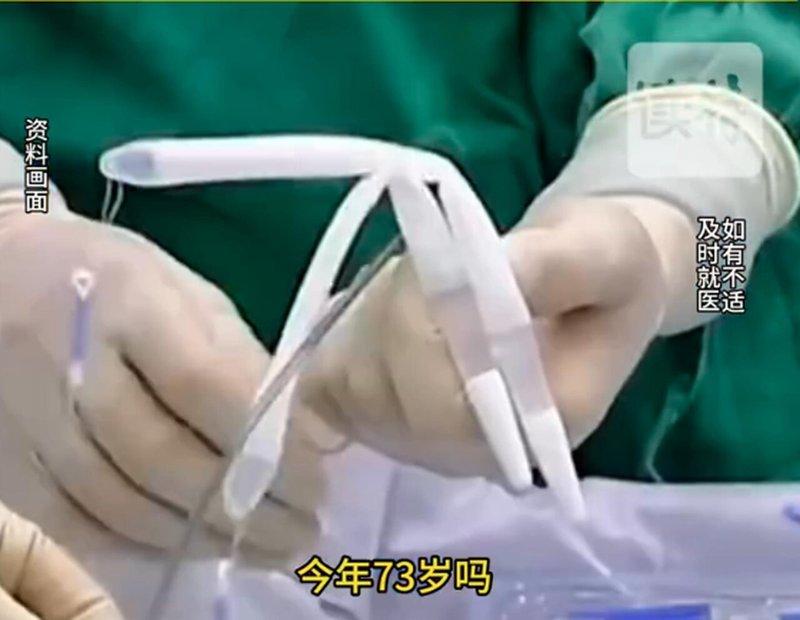 医师说植入的阴茎假体，保养得宜可使用10年甚至更久。（视频截屏）