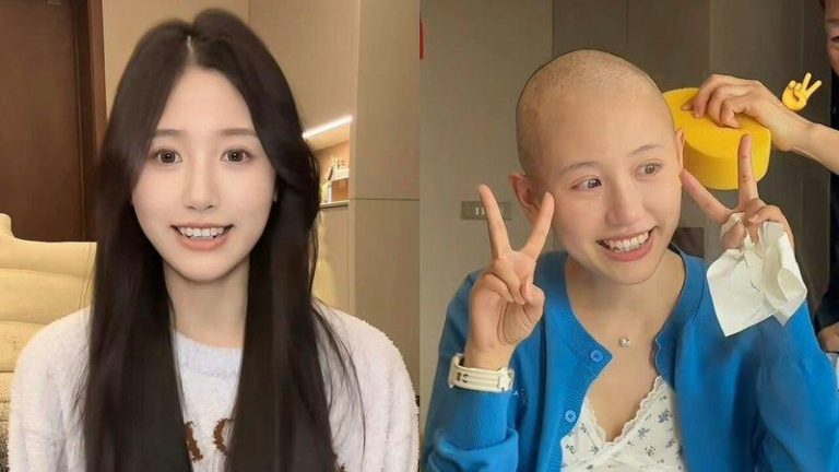 网红「一栗小莎子」因为化疗剃光头。图／摘自一栗小莎子微博