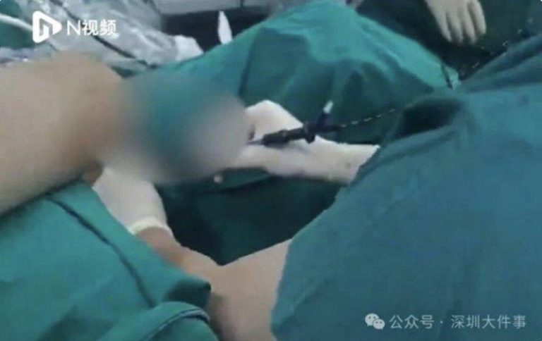 深圳男买硅胶DIY注射 那话儿肿得像萝卜 差点当了公公 深圳男子网购硅胶注射,造成下体溃烂、流脓。(取材自微信)