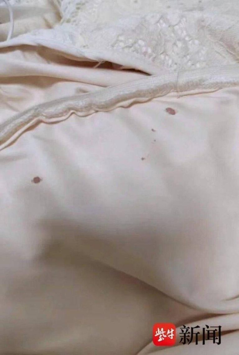 122包裹94个仅退款…女子网购发现住家整个街道被「拉黑」 小王收到的退货上衣沾有污渍。(取材自大河报)