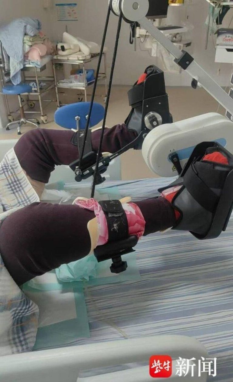 生存希望0.1% 湖北母请中医熬「还魂汤」救脑损儿 现奇迹 母亲为赵射做复健训练。(取材自紫牛新闻)