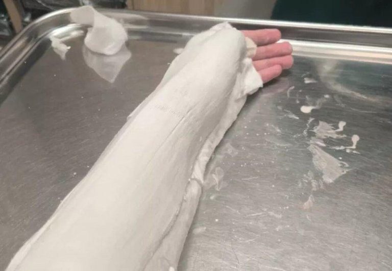 中国留学生在雪梨遭游民掰断手指 警1句话透露歧视味 一名中国留学生发帖称,在雪梨麦当劳享用薯条时突遭一名疑似游民袭击,导致手指受伤。...