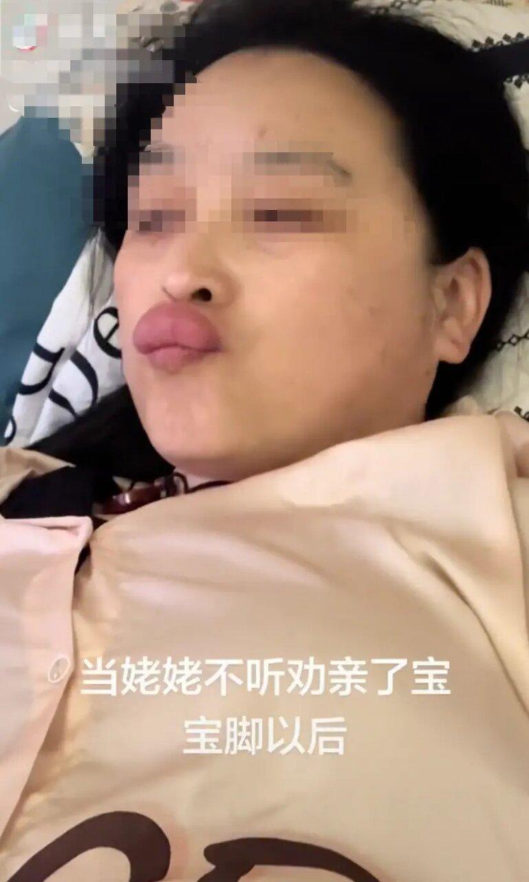 河北一名姥姥因亲吻婴儿脚丫导致唇部肿胀。(视频截屏)