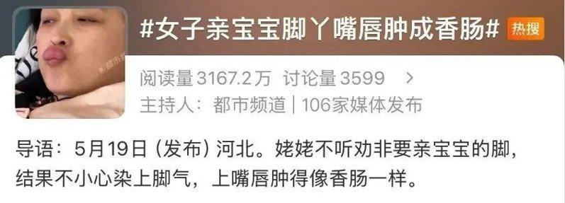 河北一名姥姥因亲吻婴儿脚丫导致唇部肿胀，在网络掀起讨论。(微博截屏)
