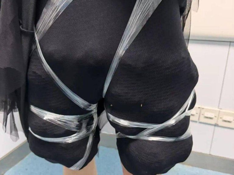 女子裙摆内用黑色紧身裤在左右大腿处绑藏了58只活体乌龟。（取材自光明网）