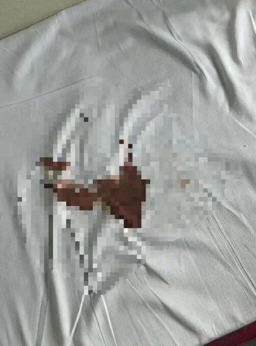张女士弄脏的床单。(取材自极目新闻)