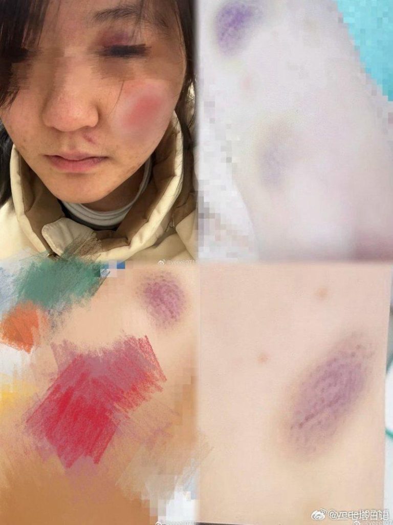 16岁女控遭殴打、控制 江西财大男遭查 妈喊「学校打点好了」 一名16岁的未成年女生23日在微博发布长文,公开指控该校大一男生叶某对其进行长期...