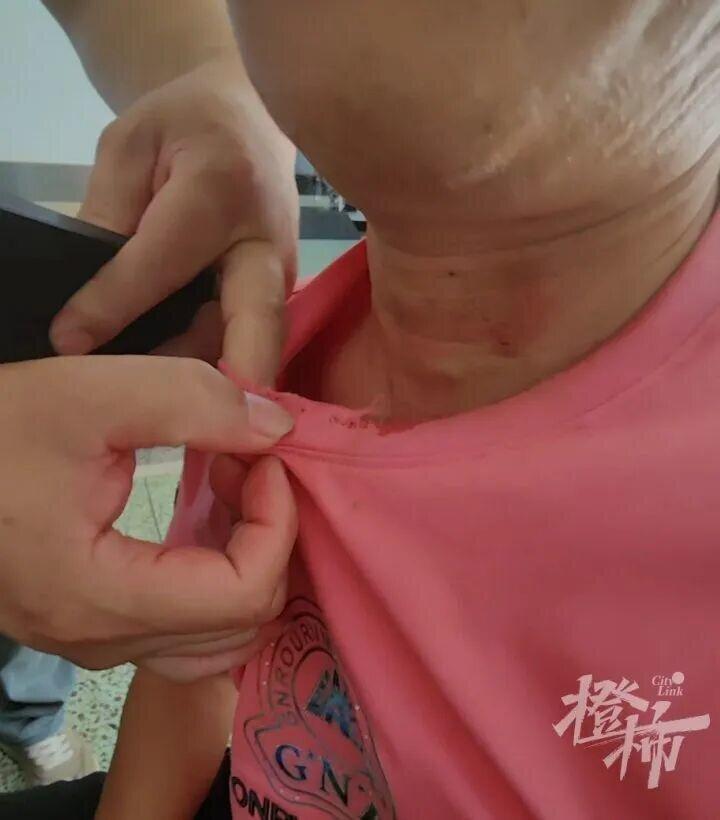 男子解救大蛇,反遭「锁喉」。(取材自都市快报橙柿交互)