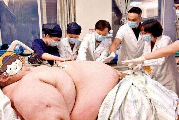 多学科专家为晓洲会诊,制定减重手术方案。(取材自上观新闻)