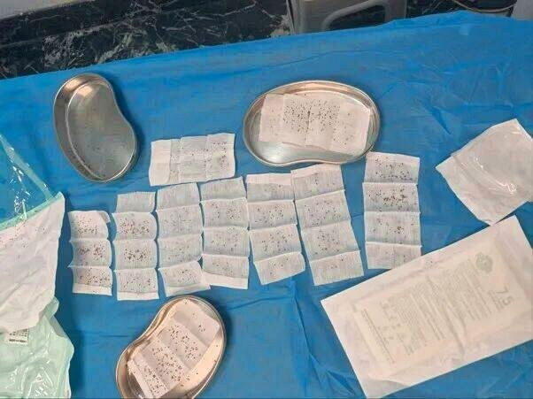 桌上摆满拔下来的毒刺,怵目惊心。(取材自新晚报)