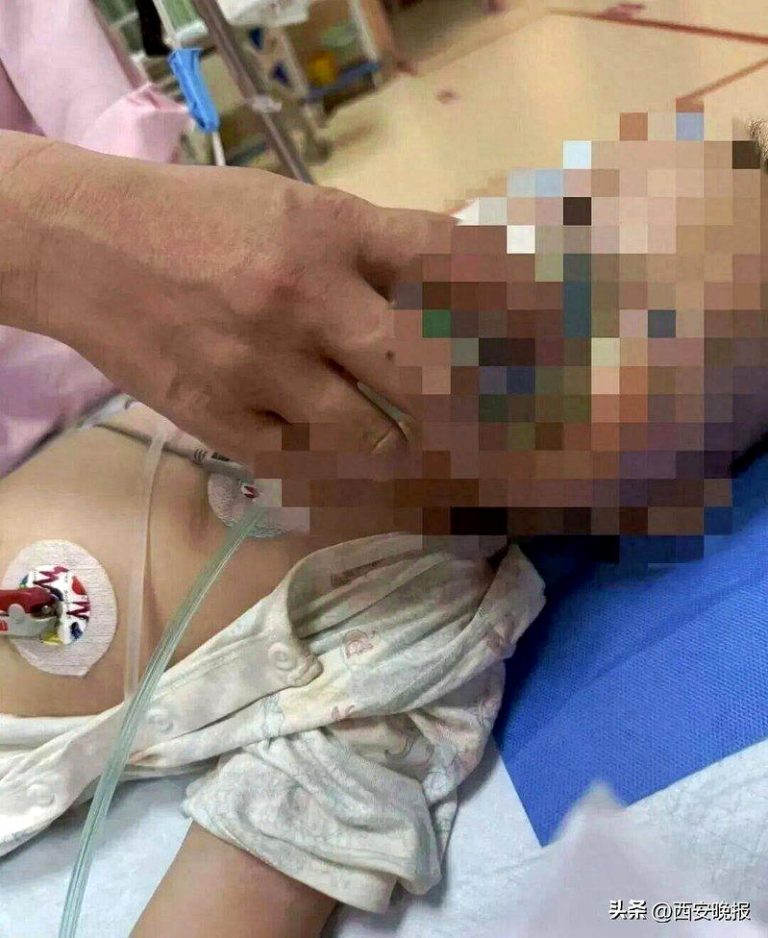 贵州1岁童误食毒鸡蛋脑萎缩 邻居自首…甩锅黄鼠狼? 颜先生1岁的儿子吃了毒鸡蛋,被送医抢救。(取材自西安晚报/受访者供图)